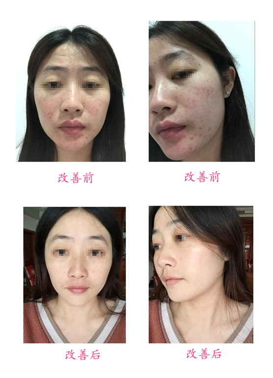 改善前后對(duì)比
