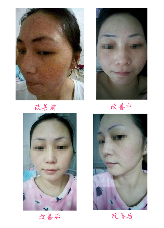 改善前后對比