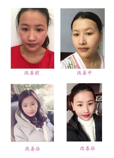 改善前后對(duì)比