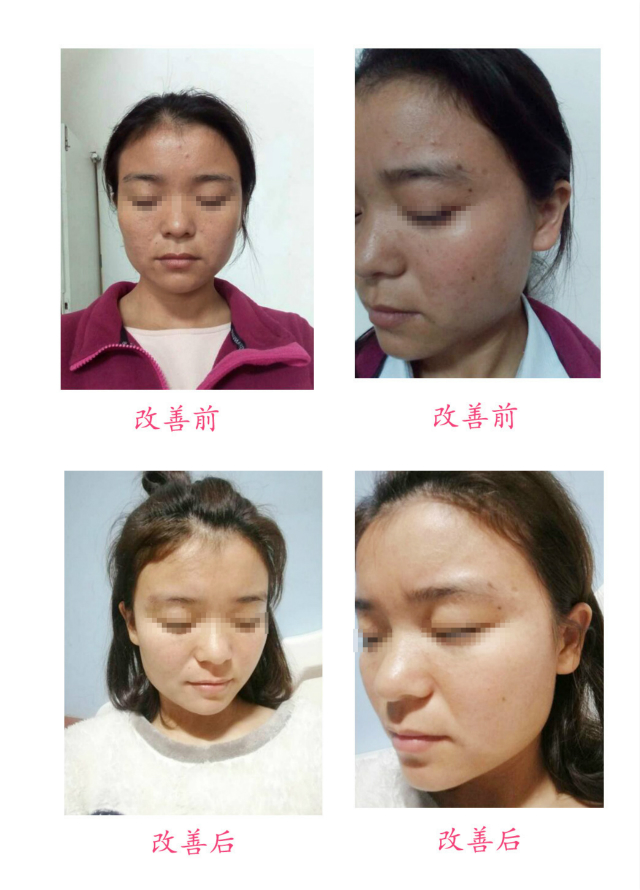 改善前后對比