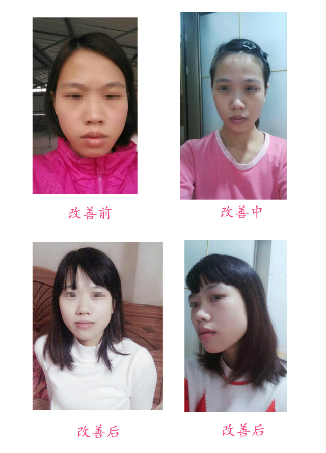 改善前后對比