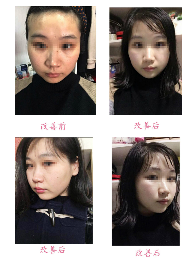 改善前后對(duì)比