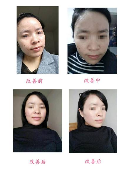 改善前后對比