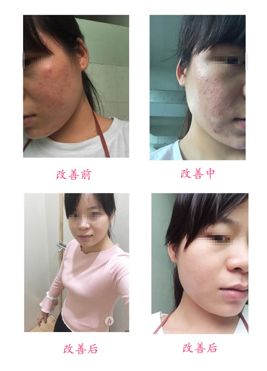 改善前后對(duì)比