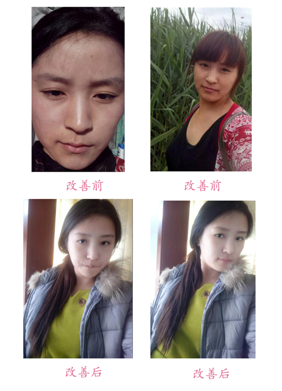 改善前后對(duì)比