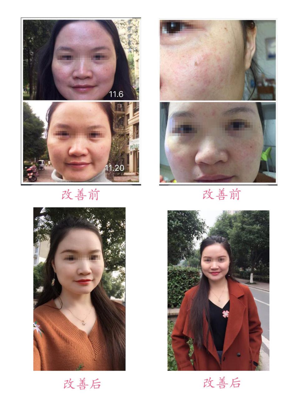 改善前后對比
