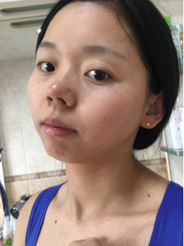 現(xiàn)在的我肌膚越來越好
