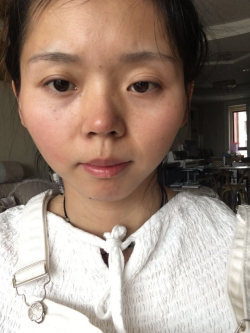 改善前后對比照