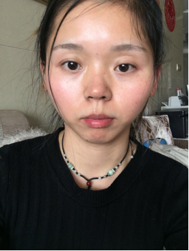 改善前后對比照