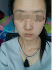 皮膚敏感