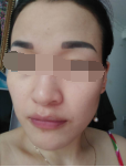 斑點敏感暗黃