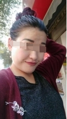 三次復診