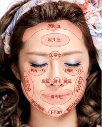 臉上長痘對應(yīng)身體器官