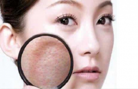 珍妮膚：你的毛孔在越變越大嗎？