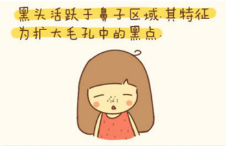 黑頭天天見~真的拿它沒辦法了嗎？