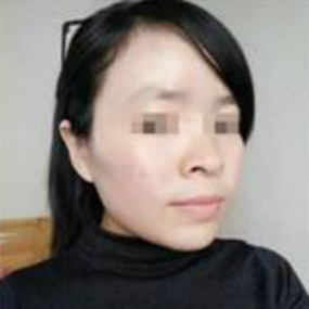 成為寶媽之后，如何早日下“斑”？